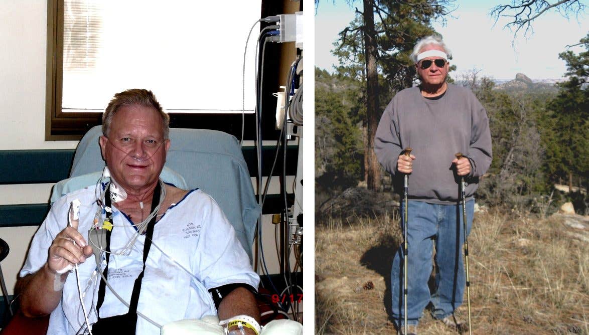 Rick McKeon before after plant-based diet obesity Rick McKeon before after plant-based diet obesity